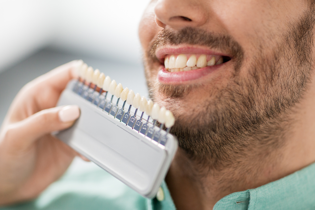 Gülüş Tasarımı (Estetik Diş Hekimliği)