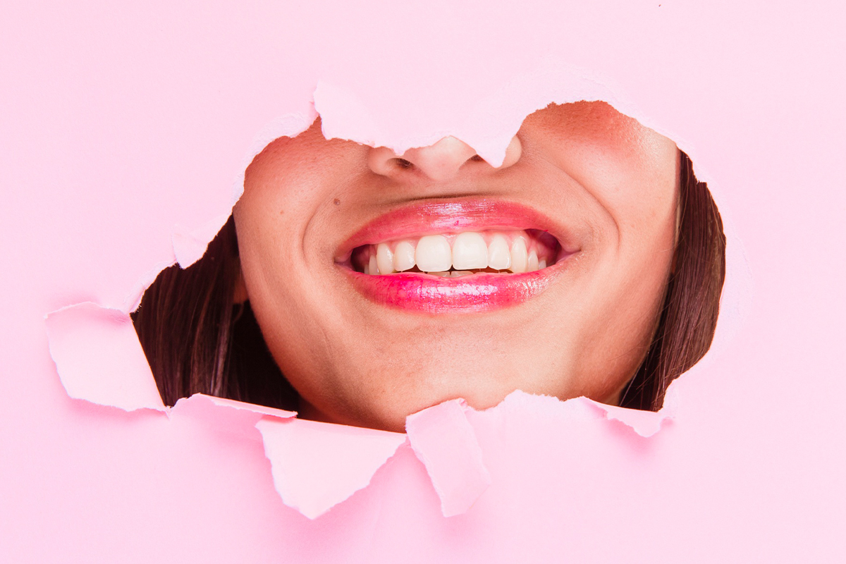 Gülüş Tasarımı: Doğal ve Estetik Gülüşlere Ulaşmanın Sırları